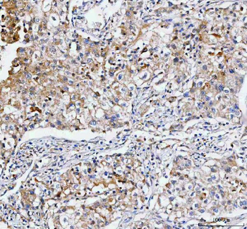Anti-IFT74 Antibody