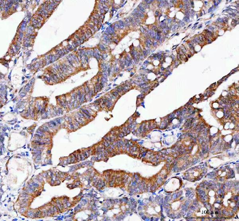 Anti-IFT74 Antibody