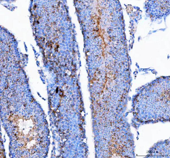 Anti-IFT74 Antibody