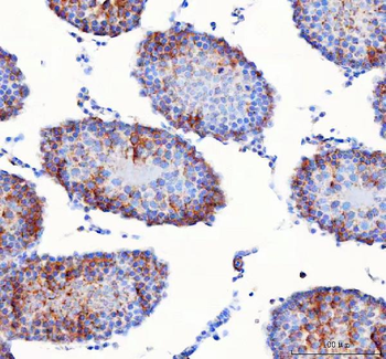 Anti-IFT74 Antibody
