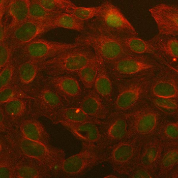 Anti-BCL3 Antibody