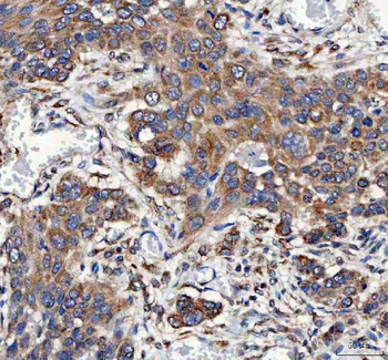 Anti-Mitofilin/IMMT Antibody