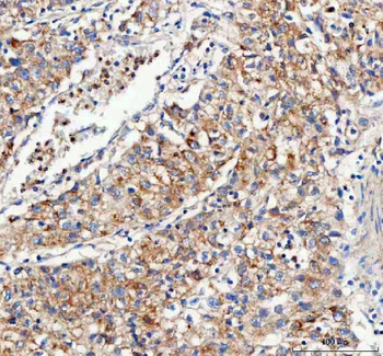 Anti-Mitofilin/IMMT Antibody