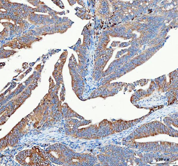 Anti-Mitofilin/IMMT Antibody