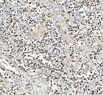 Anti-Mitofilin/IMMT Antibody