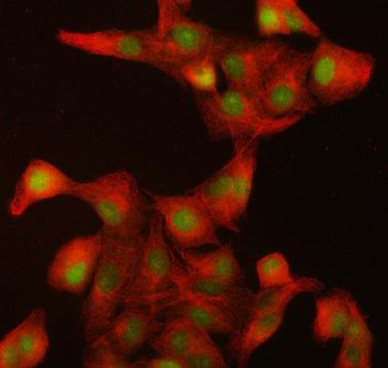 Anti-ILKAP Antibody
