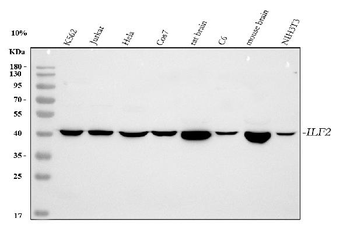 Anti-NF45/ILF2 Antibody