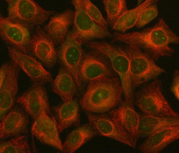 Anti-NF45/ILF2 Antibody
