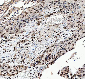 Anti-NF45/ILF2 Antibody
