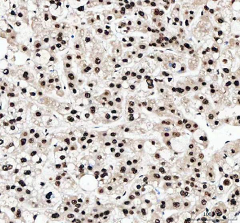 Anti-NF45/ILF2 Antibody