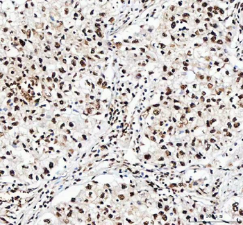 Anti-NF45/ILF2 Antibody