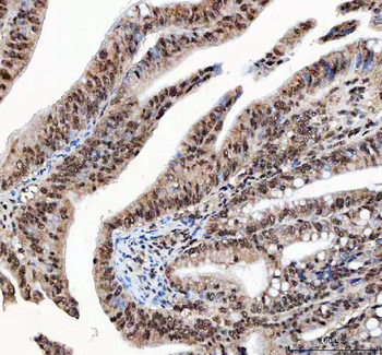 Anti-NF45/ILF2 Antibody