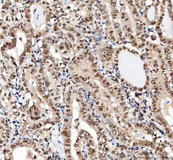 Anti-NF45/ILF2 Antibody