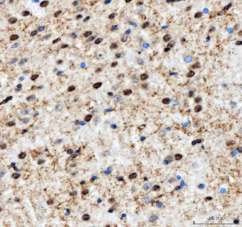 Anti-NF45/ILF2 Antibody