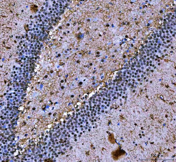 Anti-NF45/ILF2 Antibody