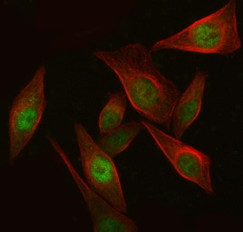 Anti-IKZF3 Antibody
