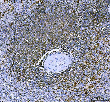 Anti-IKZF3 Antibody