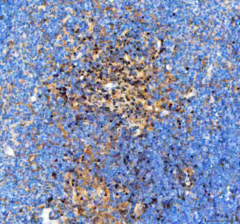 Anti-IKZF3 Antibody