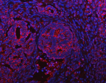 Anti-IFT52 Antibody