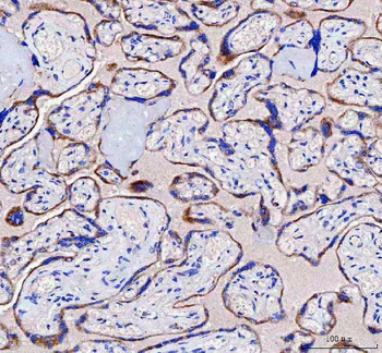 Anti-IFT52 Antibody