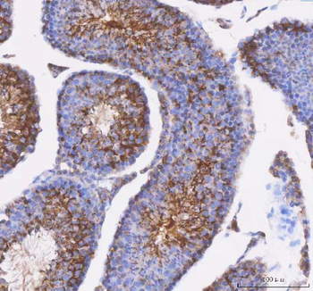 Anti-IFT52 Antibody