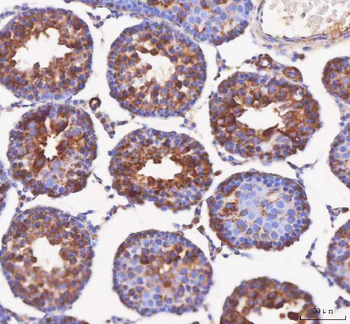 Anti-IFT52 Antibody
