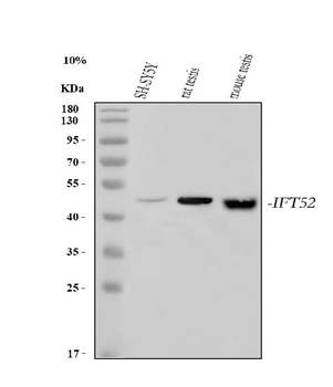 Anti-IFT52 Antibody