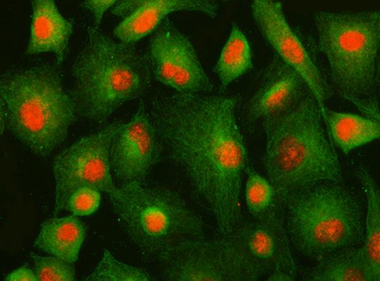 Anti-IFFO1 Antibody