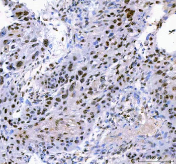Anti-IFFO1 Antibody