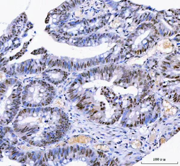 Anti-IFFO1 Antibody