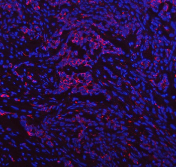 Anti-IDUA Antibody