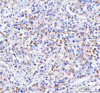 Anti-IDUA Antibody