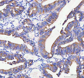 Anti-IDUA Antibody