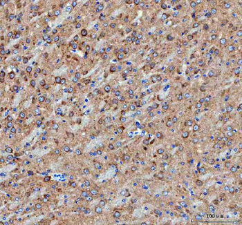 Anti-IDUA Antibody