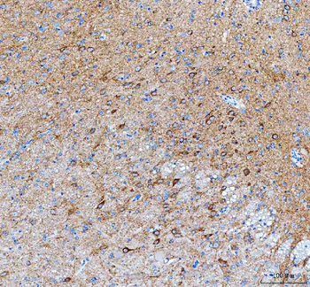 Anti-IDUA Antibody