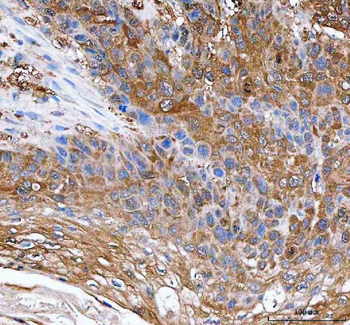 Anti-IDI1 Antibody