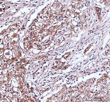 Anti-IDI1 Antibody