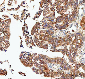 Anti-IDI1 Antibody
