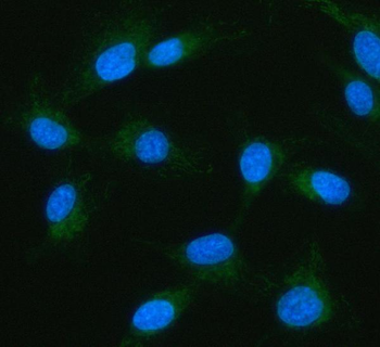 Anti-IDH3G Antibody