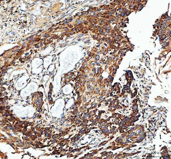 Anti-IDH3G Antibody