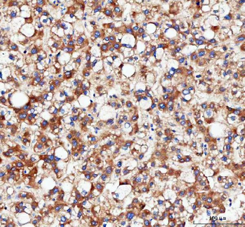 Anti-IDH3G Antibody