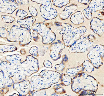 Anti-IDH3G Antibody