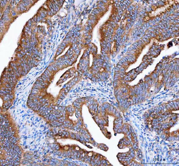 Anti-IDH3G Antibody