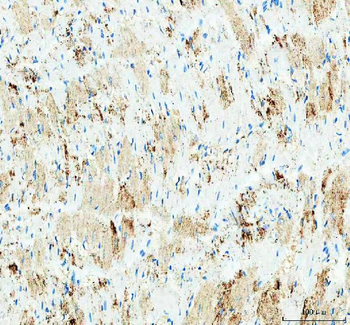 Anti-IDH3G Antibody