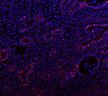 Anti-IDH3A Antibody
