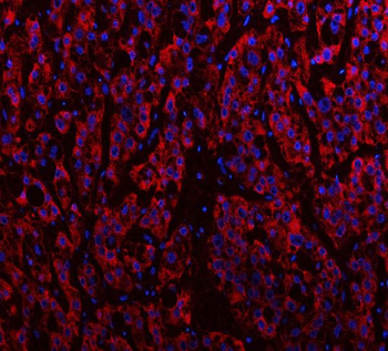 Anti-IDH3A Antibody
