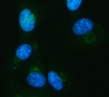 Anti-IDH3A Antibody
