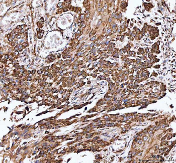 Anti-IDH3A Antibody