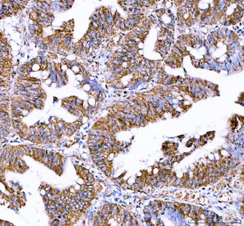 Anti-IDH3A Antibody