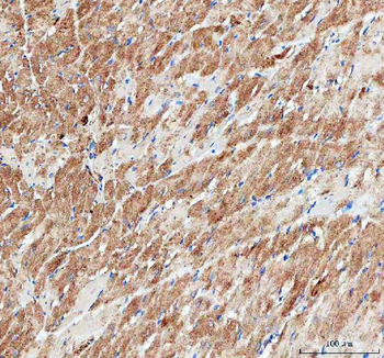 Anti-IDH3A Antibody